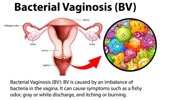 Gardnerella Vaginalis treatment
