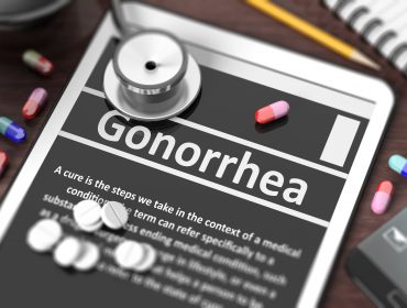 oral gonorrhea symptoms