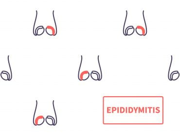 can you get epididymitis without having an std 

