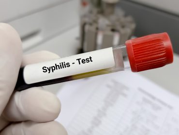 late latent syphilis