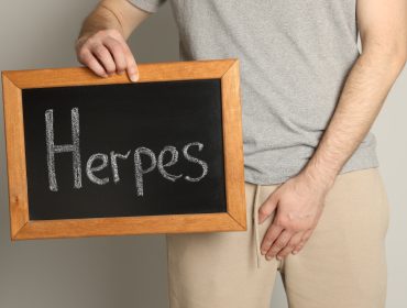 can you get rid of herpes