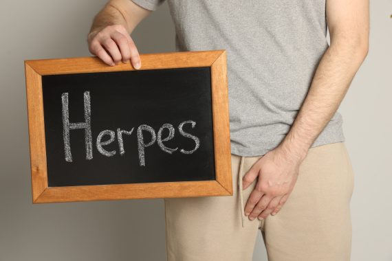 can you get rid of herpes