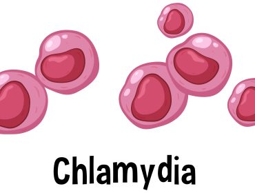 chlamydia from kissing